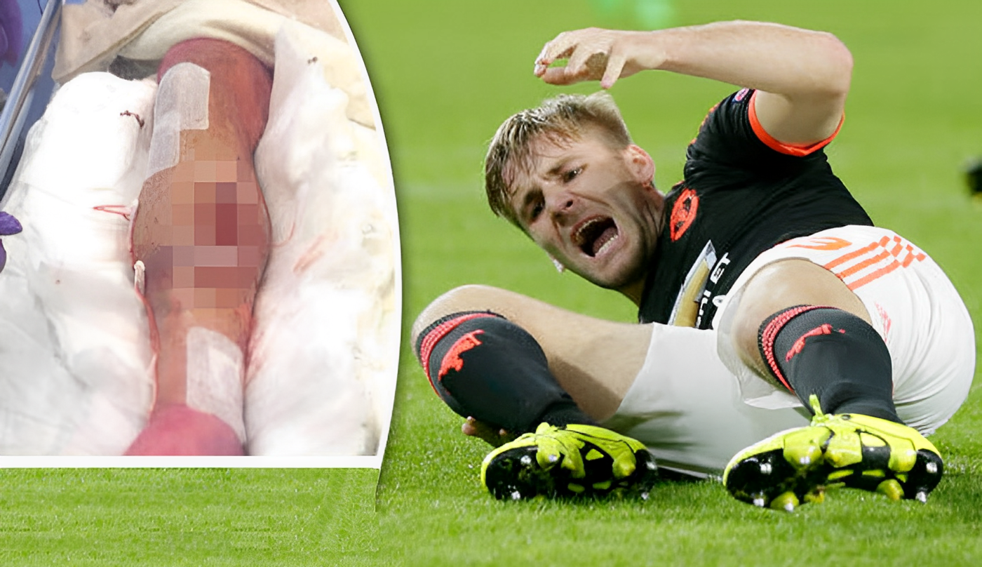 8 Chấn Thương Trong Bóng Đá Thường Gặp